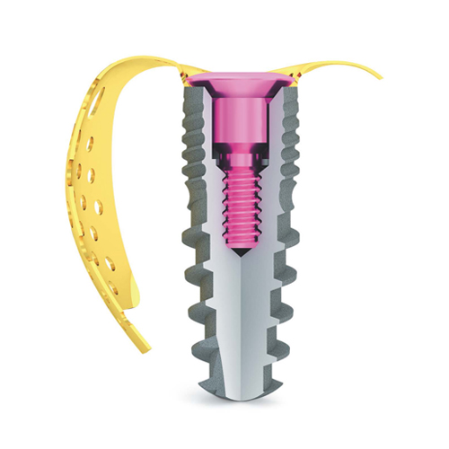 Bionika Titanium Membrane